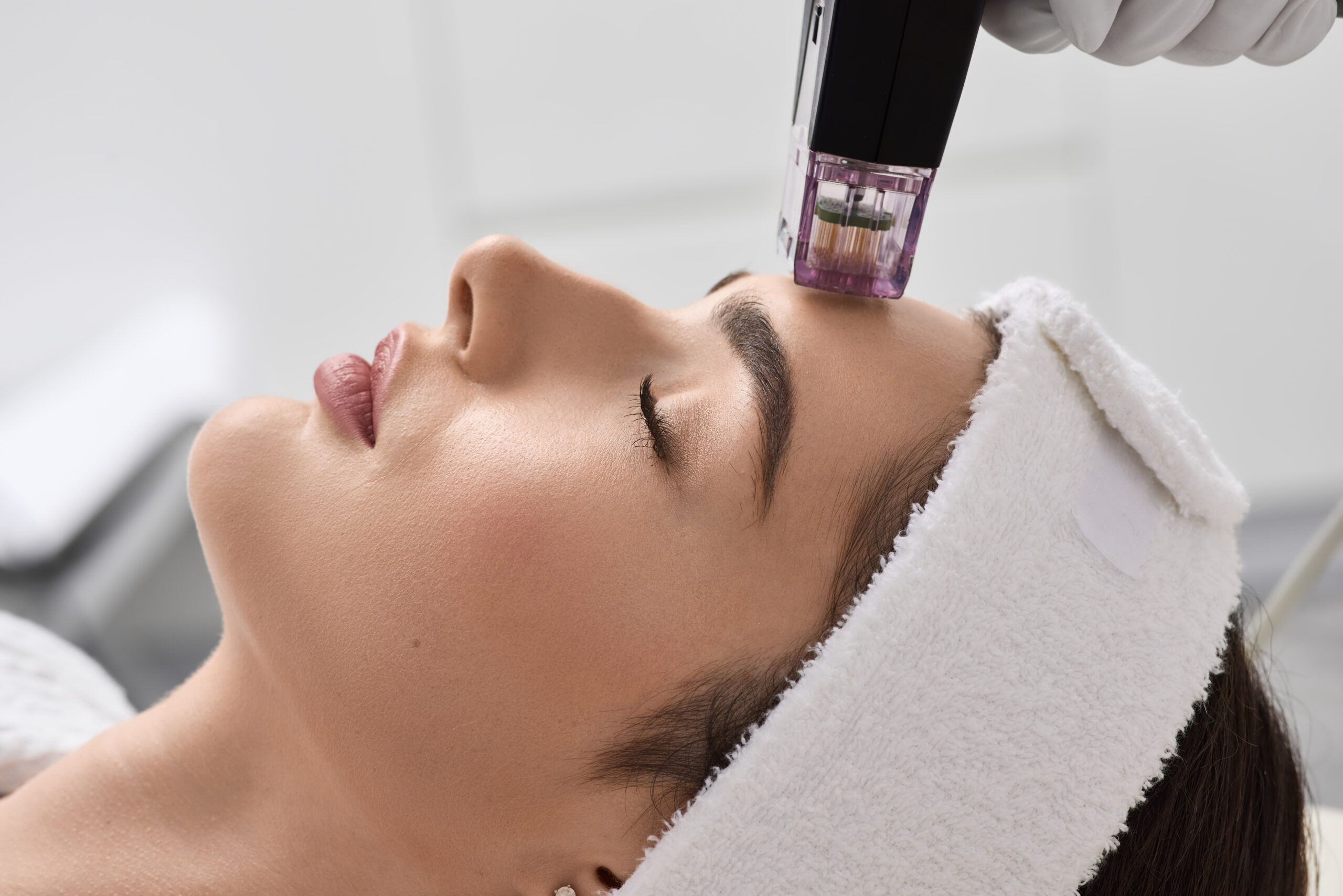 Advanced Facial Sculpting and Skin Tightening with TriLift Technology at Bright Beauty Medspa
