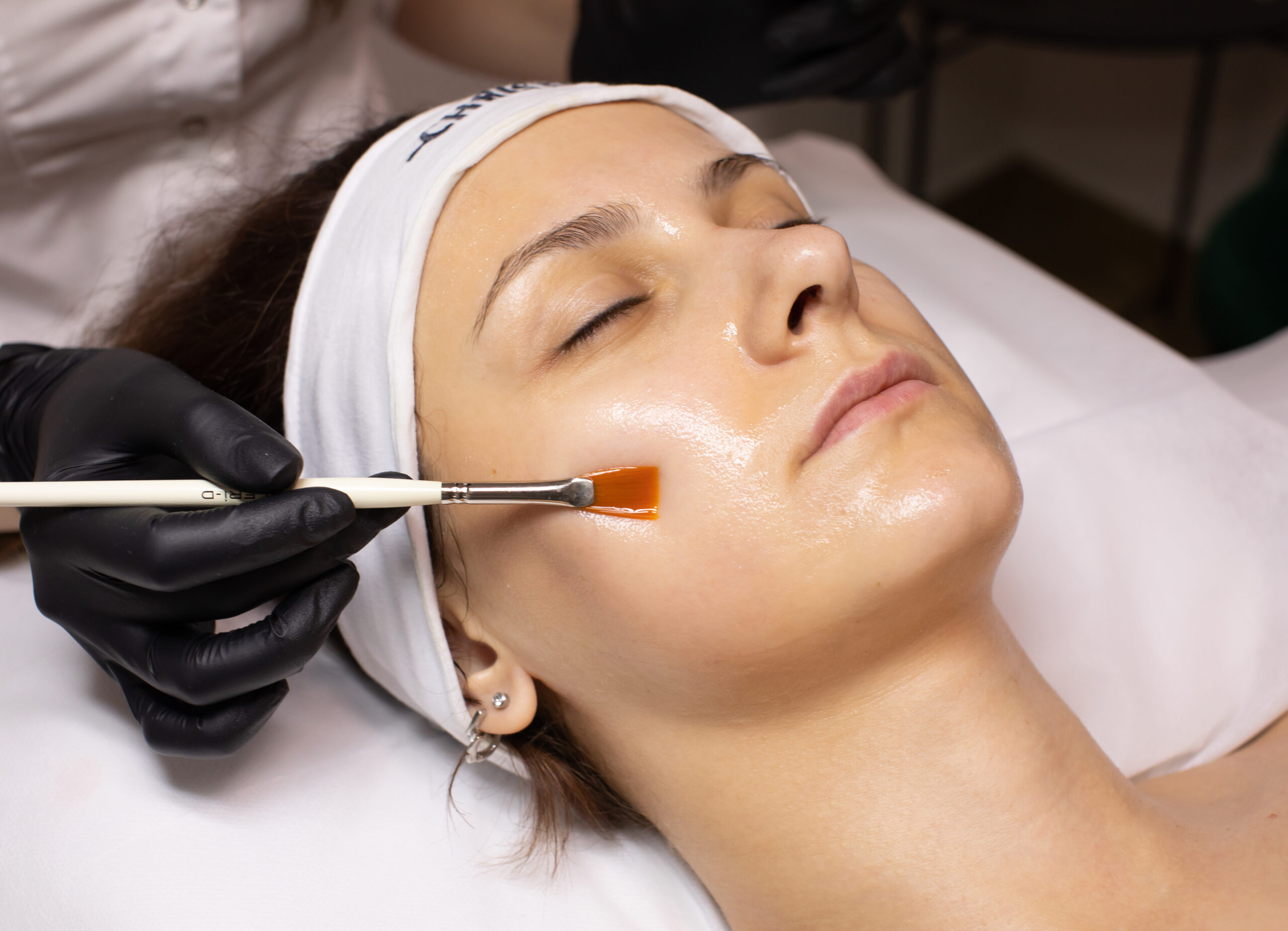 Luminous Skin with Personalized Chemical Peel and Facial Care At Bright Beauty Medspa